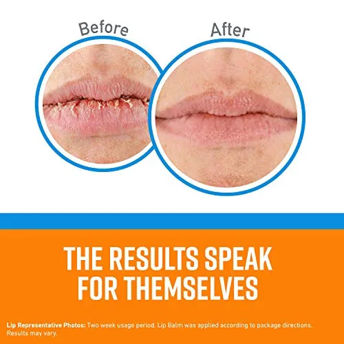 O'Keeffe's Cooling Relief Lip Repair Lip Balm for Dry Cracked Lips, Instant Cooling Relief, Seven Moisturizing Ingredients, Stick, (Pack of 1), K1710120