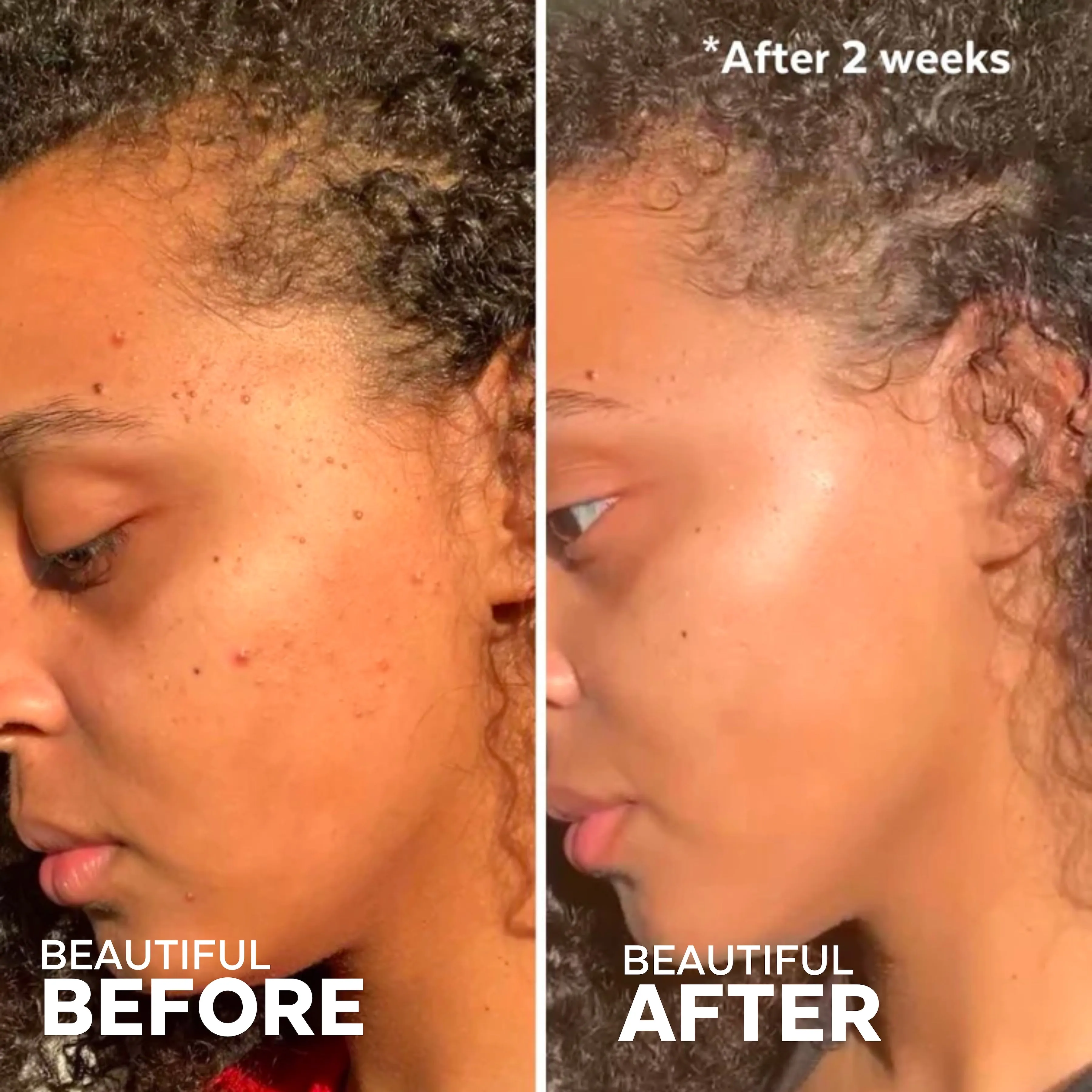 Superfruit AHA Exfoliating Mask